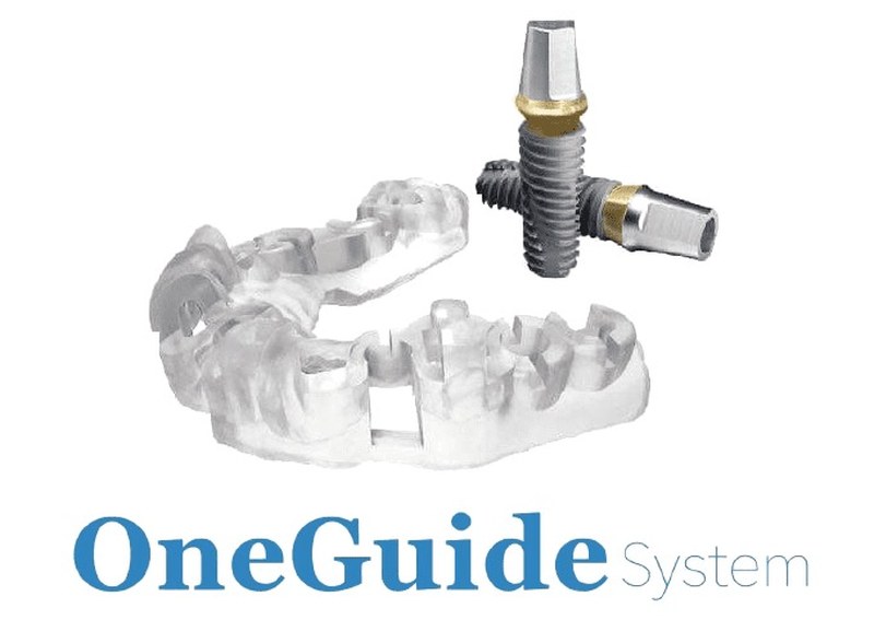 サージカルガイド（OneGuide System）— CT診断データに基づく専用ガイドとインプラント体